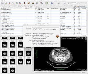 Osirix Offline Storage